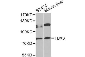 Western blot analysis of extracts of various cell lines, using TBX3 antibody (ABIN5972282) at 1/1000 dilution. (TBX3 Antikörper)