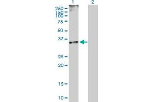 Western Blot analysis of CDK5 expression in transfected 293T cell line by CDK5 MaxPab polyclonal antibody. (CDK5 Antikörper  (AA 1-292))