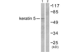 Western blot analysis of extracts from HepG2 cells, using Keratin 5 antibody (ABIN5976441). (Cytokeratin 5 Antikörper  (C-Term))