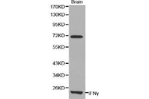 Western Blotting (WB) image for anti-Interferon gamma (IFNG) (AA 24-166) antibody (ABIN6213712) (Interferon gamma Antikörper  (AA 24-166))