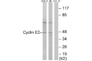 Immunohistochemistry analysis of paraffin-embedded human thyroid gland tissue using Cyclin(Ab-392) antibody. (Cyclin E2 Antikörper)