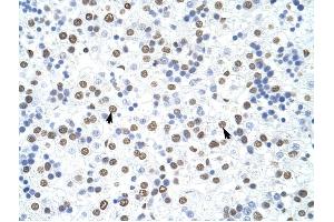 HNRPD antibody was used for immunohistochemistry at a concentration of 4-8 ug/ml to stain Hepatocytes (arrows) in Human Liver. (HNRNPD/AUF1 Antikörper)