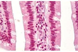 Anti-TP53 / p53 antibody IHC staining of human small intestine. (p53 Antikörper  (acLys379))