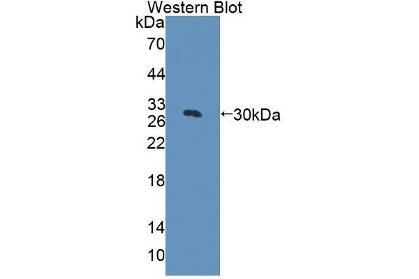 Acetyl-CoA Carboxylase beta Antikörper  (AA 29-249)