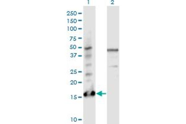 Parathymosin Antikörper  (AA 1-102)