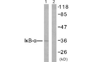 Western blot analysis of extracts from 293 cells untreated or treated with TNF-α (20ng/ml, 30min), using IκB-α (Ab-42) antibody (#B7116). (NFKBIA Antikörper  (Tyr42))
