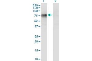 Western Blot analysis of CBFA2T2 expression in transfected 293T cell line by CBFA2T2 monoclonal antibody (M05), clone 3A2. (CBFA2T2 Antikörper  (AA 201-304))