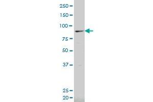 ALOX12B polyclonal antibody (A01), Lot # 051130JC01 Western Blot analysis of ALOX12B expression in Jurkat . (ALOX12B Antikörper  (AA 171-261))