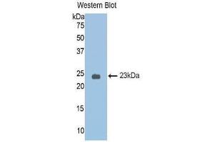 Western Blotting (WB) image for anti-serpin Peptidase Inhibitor, Clade A (Alpha-1 Antiproteinase, Antitrypsin), Member 6 (SERPINA6) (AA 25-195) antibody (ABIN1174369) (SERPINA6 Antikörper  (AA 25-195))