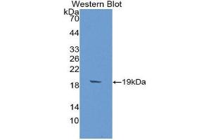 Western Blotting (WB) image for anti-alpha-2-Glycoprotein 1, Zinc-Binding (AZGP1) (AA 148-298) antibody (ABIN2117195) (AZGP1 Antikörper  (AA 148-298))