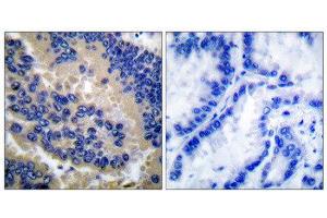 Immunohistochemistry (IHC) image for anti-Caspase 3 (CASP3) (Cleaved-Asp175) antibody (ABIN1853450) (Caspase 3 Antikörper  (Cleaved-Asp175))