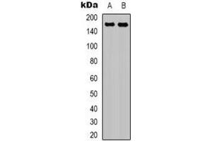 Western blot analysis of EGFR expression in A431 (A), Hela (B) whole cell lysates. (EGFR Antikörper)
