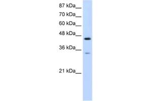 Western Blotting (WB) image for anti-Splicing Factor 3b, Subunit 4, 49kDa (SF3B4) antibody (ABIN2462194) (SF3B4 Antikörper)