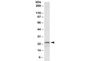 Western blot testing of K562 lysate with PSMB3 antibody at 1ug/ml. (PSMB3 Antikörper)