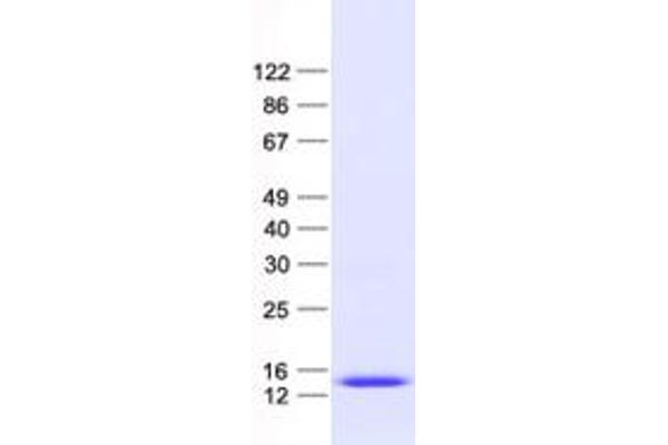 ANAPC11 Protein (His tag)