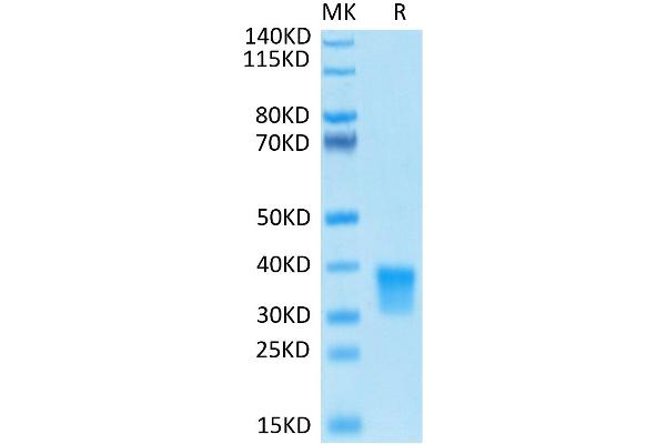 Oncostatin M Protein (OSM) (His-Avi Tag,Biotin)