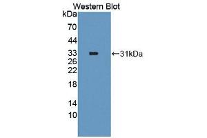 Western blot analysis of the recombinant protein. (FOXO1 Antikörper  (AA 333-557))