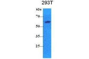 The cell lysates (40 ug) were resolved by SDS-PAGE, transferred to PVDF membrane and probed with anti-human PKLR antibody (1:500). (PKLR Antikörper  (AA 47-574))