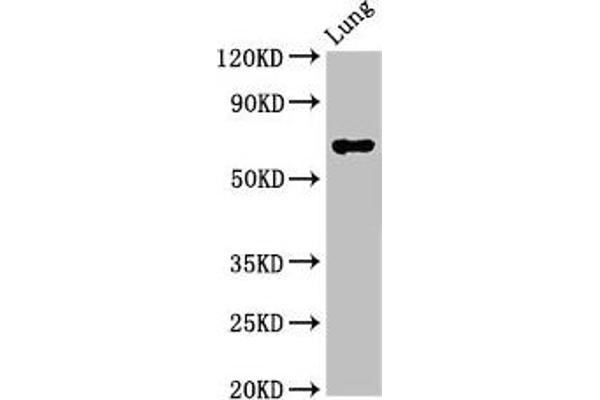 TFEB Antikörper  (AA 1-476)