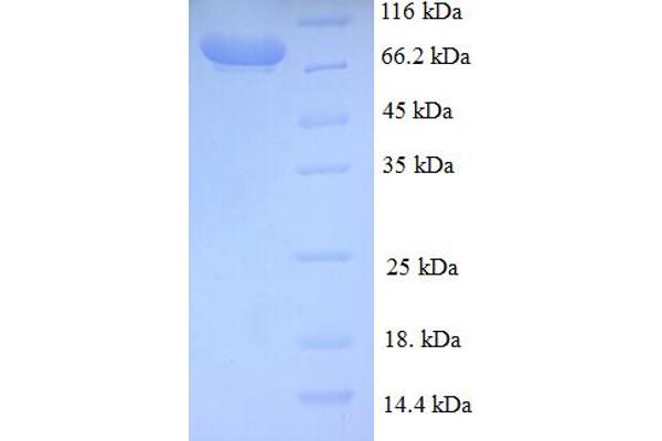 BCAS1 Protein (AA 1-584, full length) (GST tag)