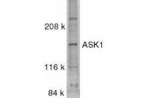 Western Blotting (WB) image for anti-Mitogen-Activated Protein Kinase Kinase Kinase 5 (MAP3K5) (C-Term) antibody (ABIN2477505) (ASK1 Antikörper  (C-Term))