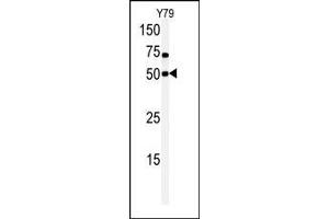 Western blot analysis of anti-hCLK1-C84 Pab in Y79 cell line lysate. (CLK1 Antikörper  (N-Term))