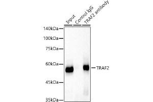 Immunoprecipitation analysis of 300 μg extracts of HeLa cells using 3 μg TR antibody . (TRAF2 Antikörper)