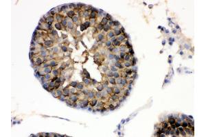 Immunohistochemistry (Paraffin-embedded Sections) (IHC (p)) image for anti-Heat Shock Protein 90kDa alpha (Cytosolic), Class A Member 1 (HSP90AA1) (AA 454-488), (C-Term) antibody (ABIN3043848) (HSP90AA1 Antikörper  (C-Term))