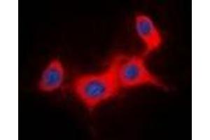 Immunofluorescent analysis of IRS1 staining in HeLa cells. (IRS1 Antikörper)
