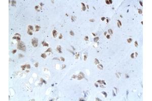 Immunohistochemistry (IHC) image for anti-Elastin (ELN) (AA 681-786) antibody (ABIN734003)