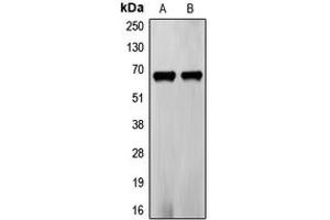 Western blot analysis of Frizzled 5 expression in PC3 (A), LOVO (B) whole cell lysates. (FZD5 Antikörper  (C-Term))