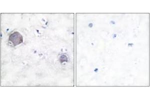 Immunohistochemistry analysis of paraffin-embedded human brain tissue, using Notch 1 (Cleaved-Val1754) Antibody. (Notch1 Antikörper  (Cleaved-Val1754))
