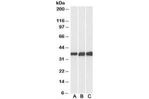 Western blot testing of human [A], mouse [B] and rat [C] heart lysates with Lactate Dehydrogenase B antibody at 0. (LDHB Antikörper)