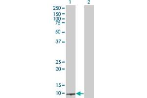 Western Blot analysis of BLID expression in transfected 293T cell line ( H00414899-T01 ) by BLID MaxPab polyclonal antibody. (BLID Antikörper  (AA 1-108))