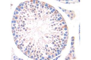 IHC-P analysis of Kidney tissue, with DAB staining. (NR6A1 Antikörper  (AA 282-480))