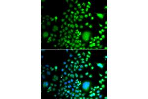Immunofluorescence analysis of A549 cells using PAX6 antibody (ABIN5975500). (PAX6 Antikörper)