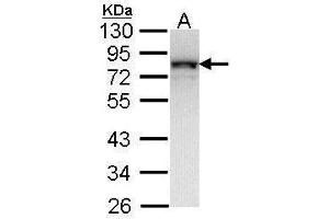 WB Image Sample (30 ug of whole cell lysate) A: Molt-4 , 12% SDS PAGE antibody diluted at 1:1000 (NDUFS1 Antikörper  (Center))