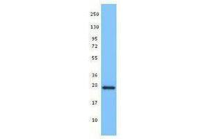 Western Blotting (WB) image for anti-BH3 Interacting Domain Death Agonist (BID) antibody (ABIN2666317) (BID Antikörper)