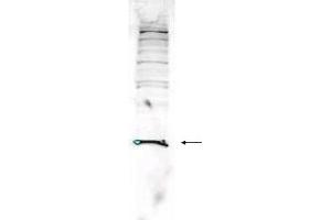 Western blot analysis is shown using  Affinity Purified anti-Human PARK7 antibody to detect PARK7 present in Jurkat whole cell lysate. (PARK7/DJ1 Antikörper  (AA 177-189))