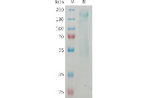 Mouse CD45 Protein, His Tag on SDS-PAGE under reducing condition. (CD45 Protein (AA 26-566) (His tag))