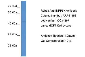 Western Blotting (WB) image for anti-Inositol Polyphosphate-5-Phosphatase K (INPP5K) (N-Term) antibody (ABIN970963) (INPP5K Antikörper  (N-Term))