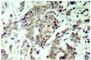 Image no. 2 for anti-Tumor Protein P53 (TP53) antibody (ABIN271765) (p53 Antikörper)