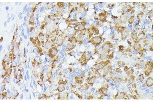 Immunohistochemistry of paraffin-embedded Rat ovary using ACAT2 Polyclonal Antibody at dilution of 1:100 (40x lens). (ACAT2 Antikörper)