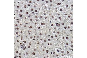 Immunohistochemistry of paraffin-embedded rat liver using PDCD7 Rabbit mAb (ABIN3022039, ABIN3022040, ABIN3022041, ABIN1513274 and ABIN1514421) at dilution of 1:100 (40x lens). (PDCD7 Antikörper)