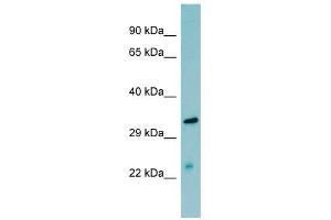 MASP2 antibody used at 1 ug/ml to detect target protein. (MASP2 Antikörper  (N-Term))