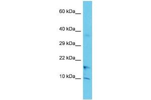 Host: Rabbit Target Name: COA1 Sample Type: Jurkat Whole Cell lysates Antibody Dilution: 1. (UBXN11 Antikörper  (C-Term))