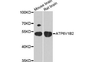 Western Blotting (WB) image for anti-ATPase, H+ Transporting, Lysosomal 56/58kDa, V1 Subunit B2 (ATP6V1B2) (AA 262-511) antibody (ABIN6220345) (ATP6V1B2 Antikörper  (AA 262-511))