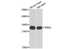 Western blot analysis of extracts of various cell lines, using TNNI3 antibody. (TNNI3 Antikörper  (AA 1-210))