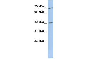 WB Suggested Anti-MEIS3 Antibody Titration:  0. (MEIS3 Antikörper  (Middle Region))