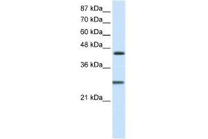 WB Suggested Anti-HES6 Antibody Titration:  1. (HES6 Antikörper  (C-Term))